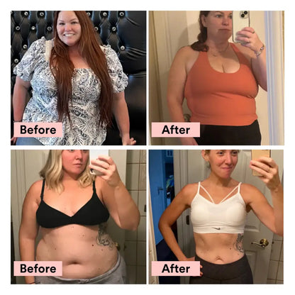 Natural Weight Management Patches - Appetite Control & Craving Support